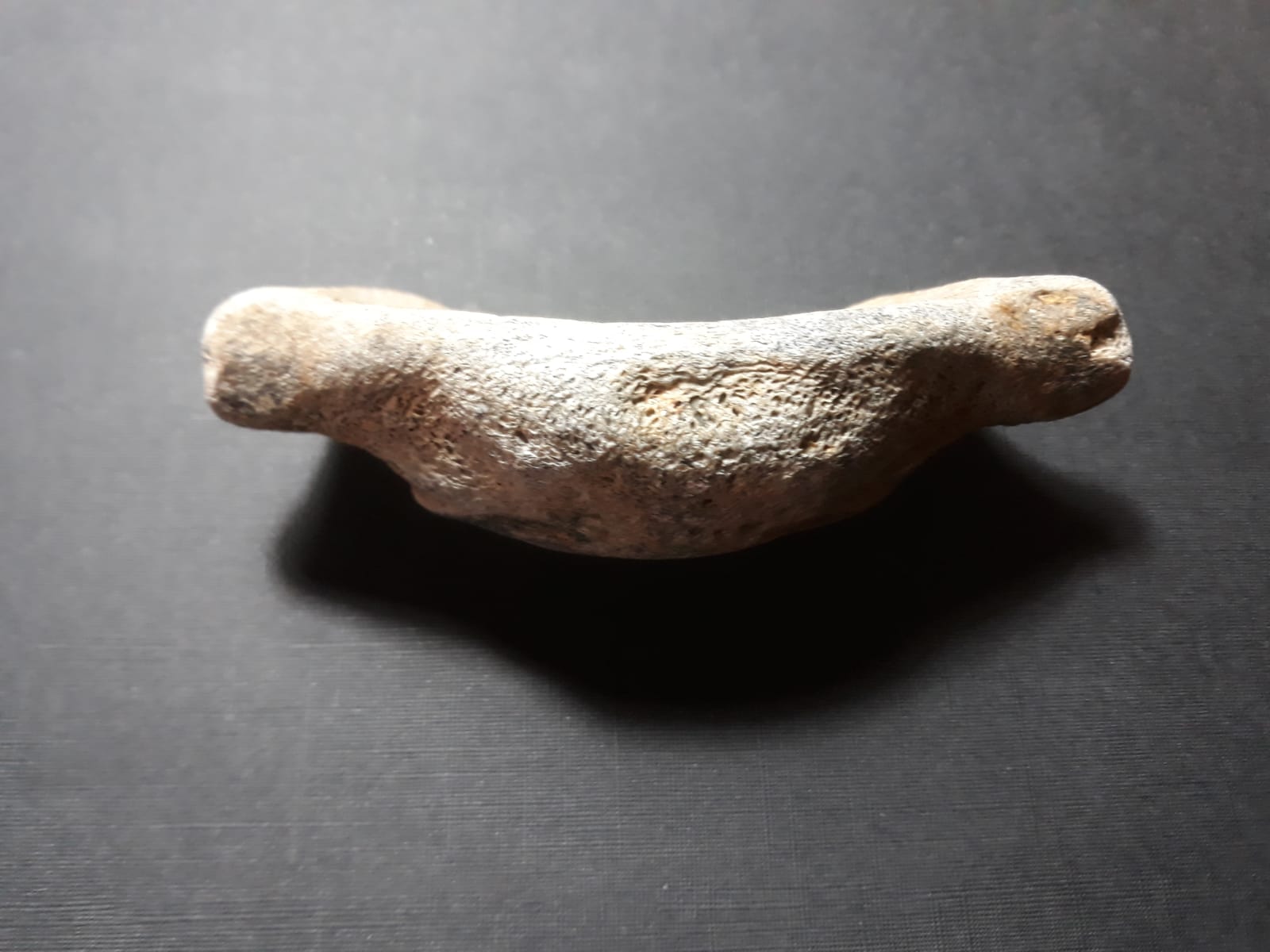 Vertebra?